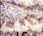 STK39 Antibody in Immunohistochemistry (IHC)