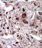 STK39 Antibody in Immunohistochemistry (IHC)