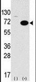 STK39 Antibody in Western Blot (WB)