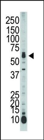 STK39 Antibody in Western Blot (WB)