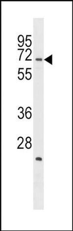 STK39 Antibody in Western Blot (WB)