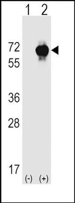 STK39 Antibody in Western Blot (WB)