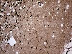 SPANXB1 Antibody in Immunohistochemistry (Paraffin) (IHC (P))