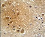SPARCL1 Antibody in Immunohistochemistry (IHC)