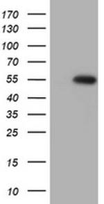 SPATA2L Antibody in Western Blot (WB)