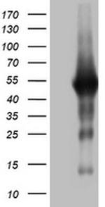SPATA2L Antibody in Western Blot (WB)