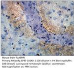 MASPIN Polyclonal Antibody