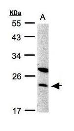 SPC24 Antibody in Western Blot (WB)