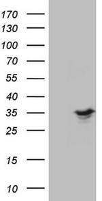 SPC25 Antibody in Western Blot (WB)