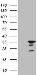 SPC25 Antibody in Western Blot (WB)