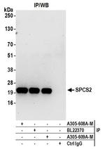 SPCS2 Antibody in Western Blot (WB)