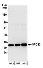 SPCS2 Polyclonal Antibody