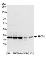 SPCS2 Polyclonal Antibody