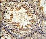 SPAG16 Antibody in Immunohistochemistry (IHC)
