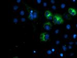 SPG7 Antibody in Immunocytochemistry (ICC/IF)