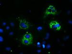 SPG7 Antibody in Immunocytochemistry (ICC/IF)