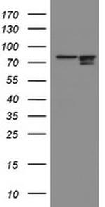 SPG7 Antibody in Western Blot (WB)