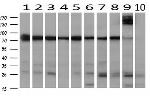 SPG7 Antibody in Western Blot (WB)
