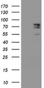 SPG7 Antibody in Western Blot (WB)