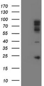 SPG7 Antibody in Western Blot (WB)