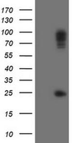 SPG7 Antibody in Western Blot (WB)