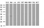 SPHK1 Antibody in Western Blot (WB)