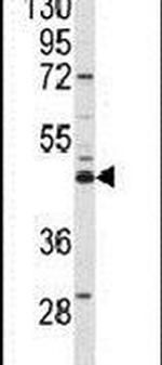 SPHK1 Antibody in Western Blot (WB)
