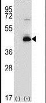SPHK1 Antibody in Western Blot (WB)