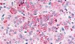SPHK1 Antibody in Immunohistochemistry (Paraffin) (IHC (P))