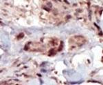 SPHK2 Antibody in Immunohistochemistry (IHC)
