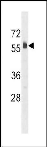SPHK2 Antibody in Western Blot (WB)