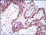 SPIB Antibody in Immunohistochemistry (Paraffin) (IHC (P))