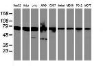 SPINT1 Antibody in Western Blot (WB)