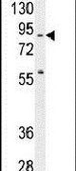 SPIRE2 Antibody in Western Blot (WB)