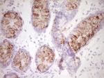 SPP1 Antibody in Immunohistochemistry (Paraffin) (IHC (P))