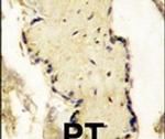 SPPL2A Antibody in Immunohistochemistry (IHC)