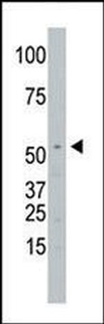 SPPL2A Antibody in Western Blot (WB)