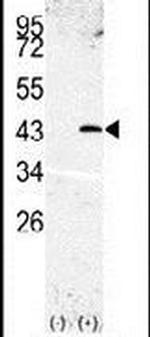 SPPL3 Antibody in Western Blot (WB)