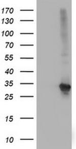 SPR Antibody in Western Blot (WB)