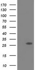 SPR Antibody in Western Blot (WB)