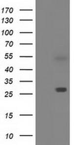 SPR Antibody in Western Blot (WB)