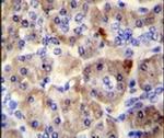 SPRED3 Antibody in Immunohistochemistry (IHC)