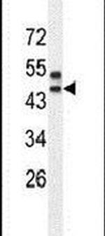 SPRED3 Antibody in Western Blot (WB)