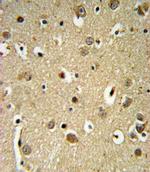 SPRY4 Antibody in Immunohistochemistry (IHC)