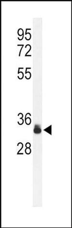 SPRY4 Antibody in Western Blot (WB)