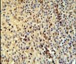 SPATA13 Antibody in Immunohistochemistry (IHC)