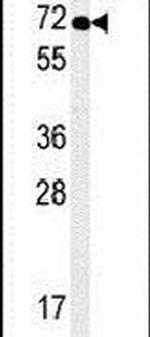 SPATA13 Antibody in Western Blot (WB)