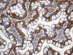 SPTAN1 Antibody in Immunohistochemistry (Paraffin) (IHC (P))
