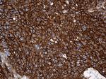 SPTAN1 Antibody in Immunohistochemistry (Paraffin) (IHC (P))