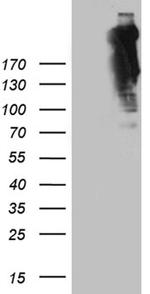 SPTAN1 Antibody in Western Blot (WB)